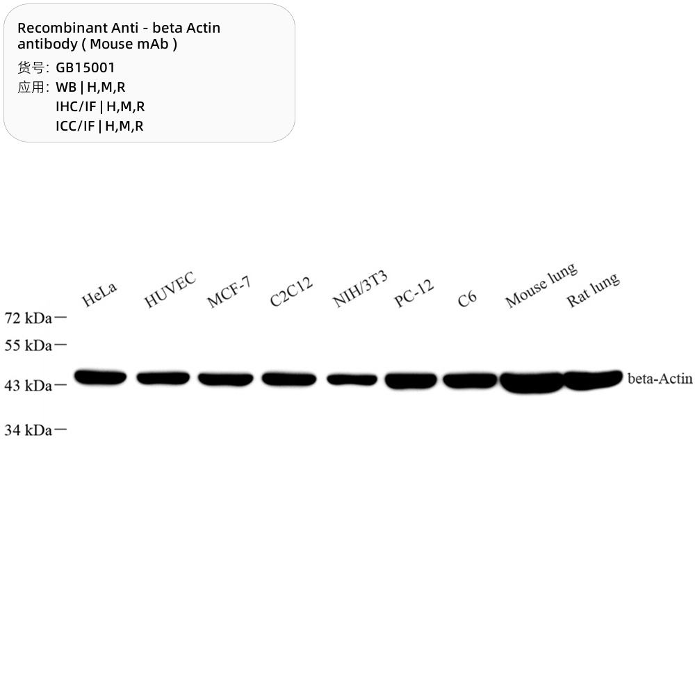 2.  Recombinant Anti – beta Actin antibody ( Mouse mAb ), $300 100 μL