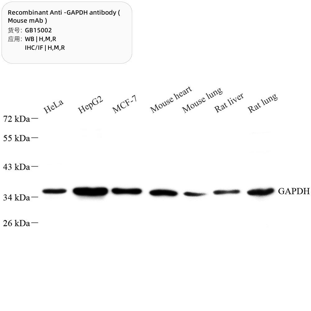 4. Recombinant Anti -GAPDH antibody ( Mouse mAb ) $300 100 μL