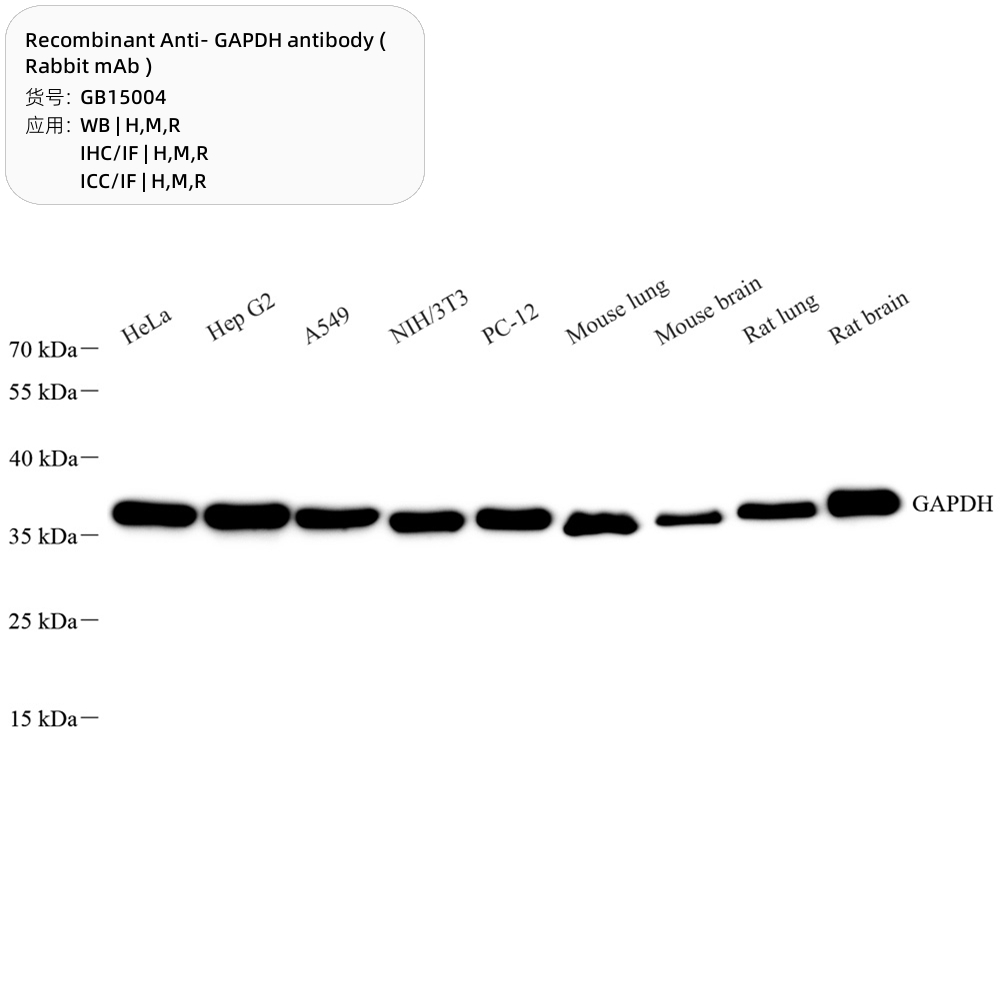 3. Recombinant Anti- GAPDH antibody ( Rabbit mAb ), 100 μL $300