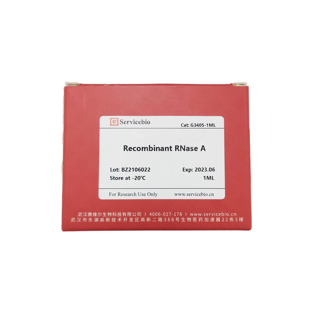 5. Recombinant RNase A (10mg/mL), 1 ml, 1 mg  $239 ,