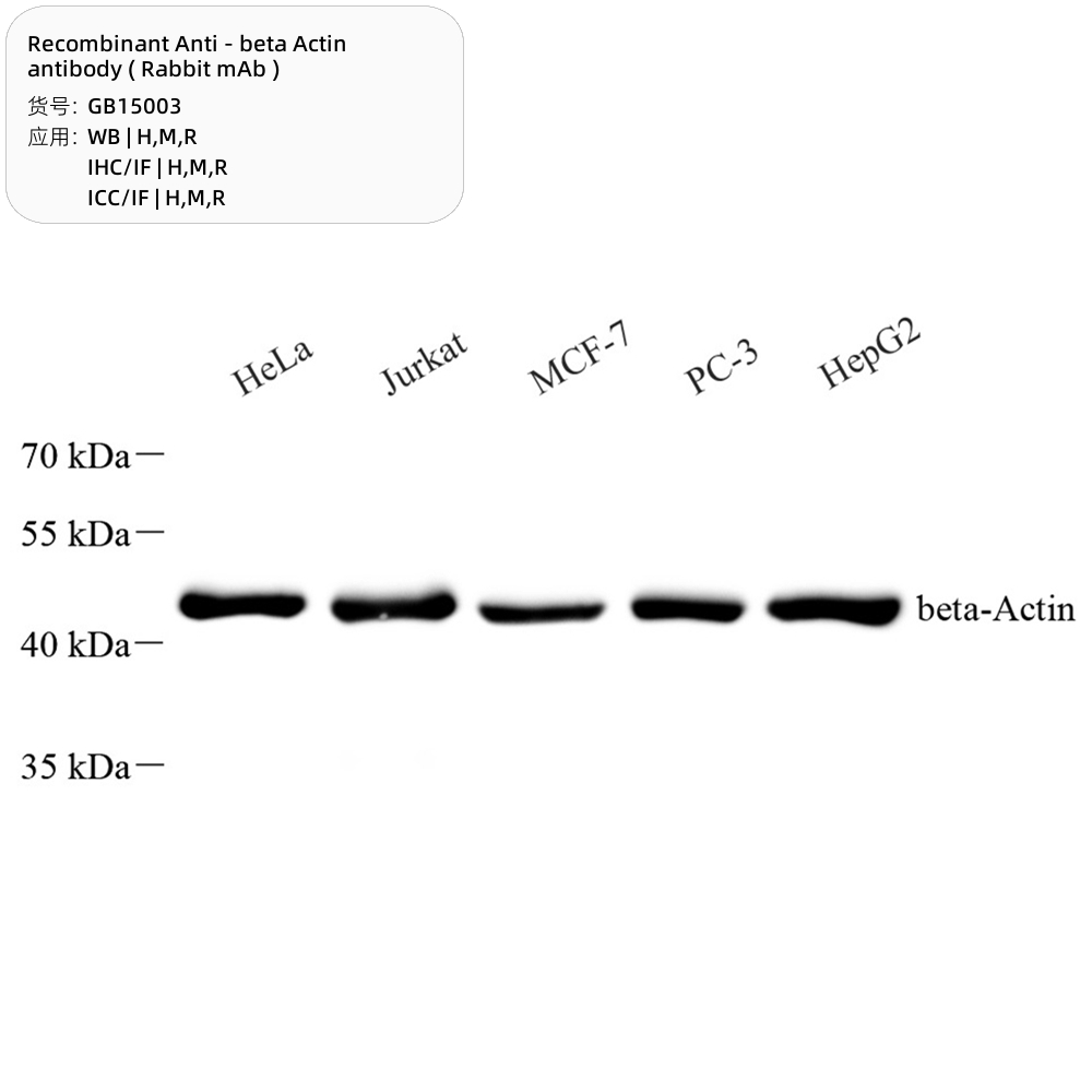 2. Recombinant Anti – beta Actin antibody ( Rabbit mAb ); 100 μL $200