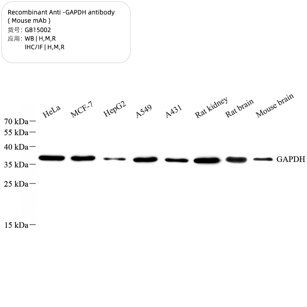 7. Recombinant Anti -GAPDH antibody ( Mouse mAb ); 100 μL $199