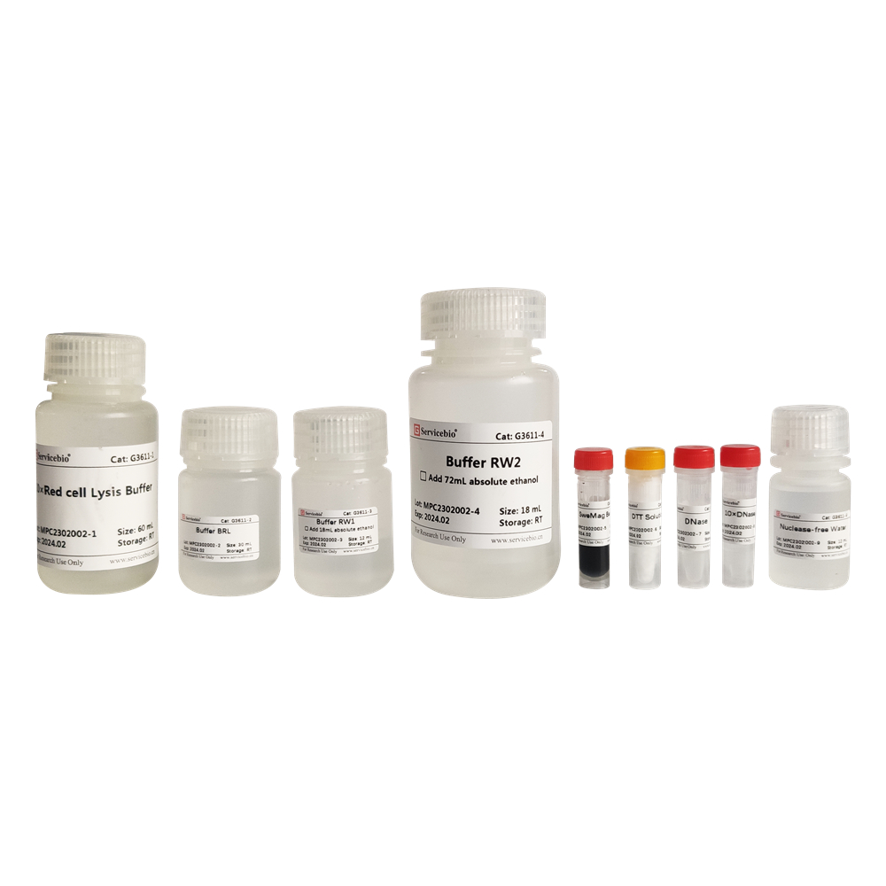 17. Blood Total RNA Extraction (Magnetic Bead-Based)  Kit
