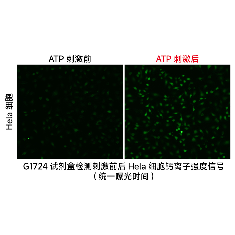 8. Fluo-4 AM Calcium Ion Fluorescence Assay Kit, $400